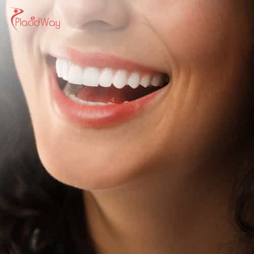 Porcelain Veneers in Turkey: Achieve the Perfect Smile with Expert Dental Treatments for Australians